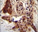 CCDC122 Antibody in Immunohistochemistry (IHC)