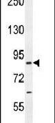 CCDC123 Antibody in Western Blot (WB)