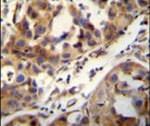 CCDC17 Antibody in Immunohistochemistry (IHC)
