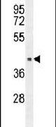 CCDC17 Antibody in Western Blot (WB)