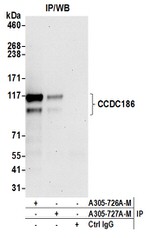 CCDC186 Polyclonal Antibody