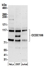 CCDC186 Polyclonal Antibody