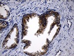 CCDC22 Antibody in Immunohistochemistry (Paraffin) (IHC (P))