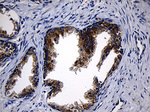 CCDC22 Antibody in Immunohistochemistry (Paraffin) (IHC (P))
