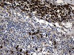 CCDC22 Antibody in Immunohistochemistry (Paraffin) (IHC (P))