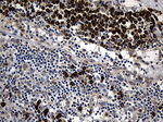 CCDC22 Antibody in Immunohistochemistry (Paraffin) (IHC (P))