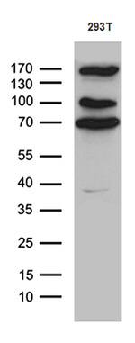 CCDC22 Antibody in Western Blot (WB)
