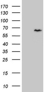 CCDC36 Antibody in Western Blot (WB)