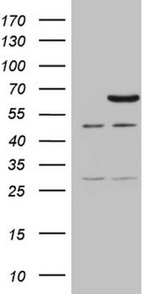 CCDC36 Antibody in Western Blot (WB)