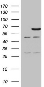 CCDC36 Antibody in Western Blot (WB)