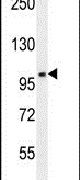 CCDC39 Antibody in Western Blot (WB)
