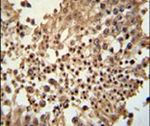 CCDC42 Antibody in Immunohistochemistry (IHC)