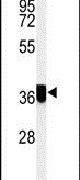 CCDC42 Antibody in Western Blot (WB)