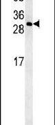 CCDC69 Antibody in Western Blot (WB)