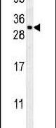 CCDC69 Antibody in Western Blot (WB)