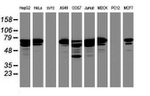 CCDC93 Antibody in Western Blot (WB)