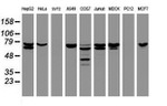 CCDC93 Antibody in Western Blot (WB)