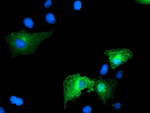 CCM2 Antibody in Immunocytochemistry (ICC/IF)