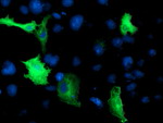 CCM2 Antibody in Immunocytochemistry (ICC/IF)