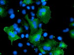 CCM2 Antibody in Immunocytochemistry (ICC/IF)