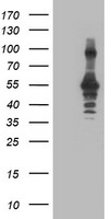 CCM2 Antibody in Western Blot (WB)