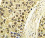 Cyclin A2 Antibody in Immunohistochemistry (IHC)