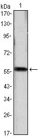 Cyclin D1 Monoclonal Antibody (3D8)