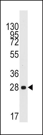 Cyclin D1 Antibody in Western Blot (WB)