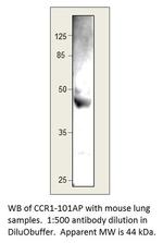 CCR1 Polyclonal Antibody