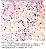 CCR3 Polyclonal Antibody