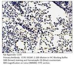 CCR5 Polyclonal Antibody