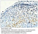 CCR6 Polyclonal Antibody