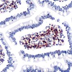 CCR7 Antibody in Immunohistochemistry (IHC)