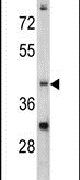 CCRN4L Antibody in Western Blot (WB)