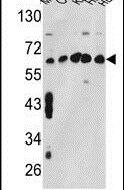 TCP-1 gamma Antibody in Western Blot (WB)