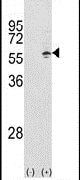 TCP-1 gamma Antibody in Western Blot (WB)