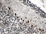 CCT4 Antibody in Immunohistochemistry (Paraffin) (IHC (P))