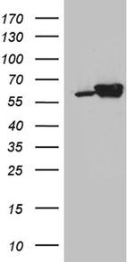 CCT4 Antibody in Western Blot (WB)