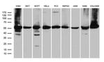 CCT4 Antibody in Western Blot (WB)