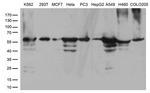 CCT4 Antibody in Western Blot (WB)