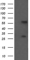 CCT8L2 Antibody in Western Blot (WB)
