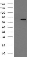 CCT8L2 Antibody in Western Blot (WB)