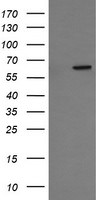 CCT8L2 Antibody in Western Blot (WB)