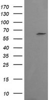 CCT8L2 Antibody in Western Blot (WB)