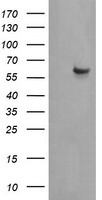 CCT8L2 Antibody in Western Blot (WB)