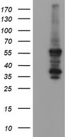 CCT8L2 Antibody in Western Blot (WB)