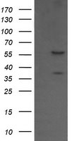 CCT8L2 Antibody in Western Blot (WB)