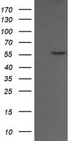 CCT8L2 Antibody in Western Blot (WB)