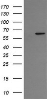 CCT8L2 Antibody in Western Blot (WB)