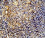 CD10 Antibody in Immunohistochemistry (IHC)